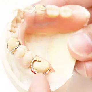 インプラント・入れ歯・ブリッジ